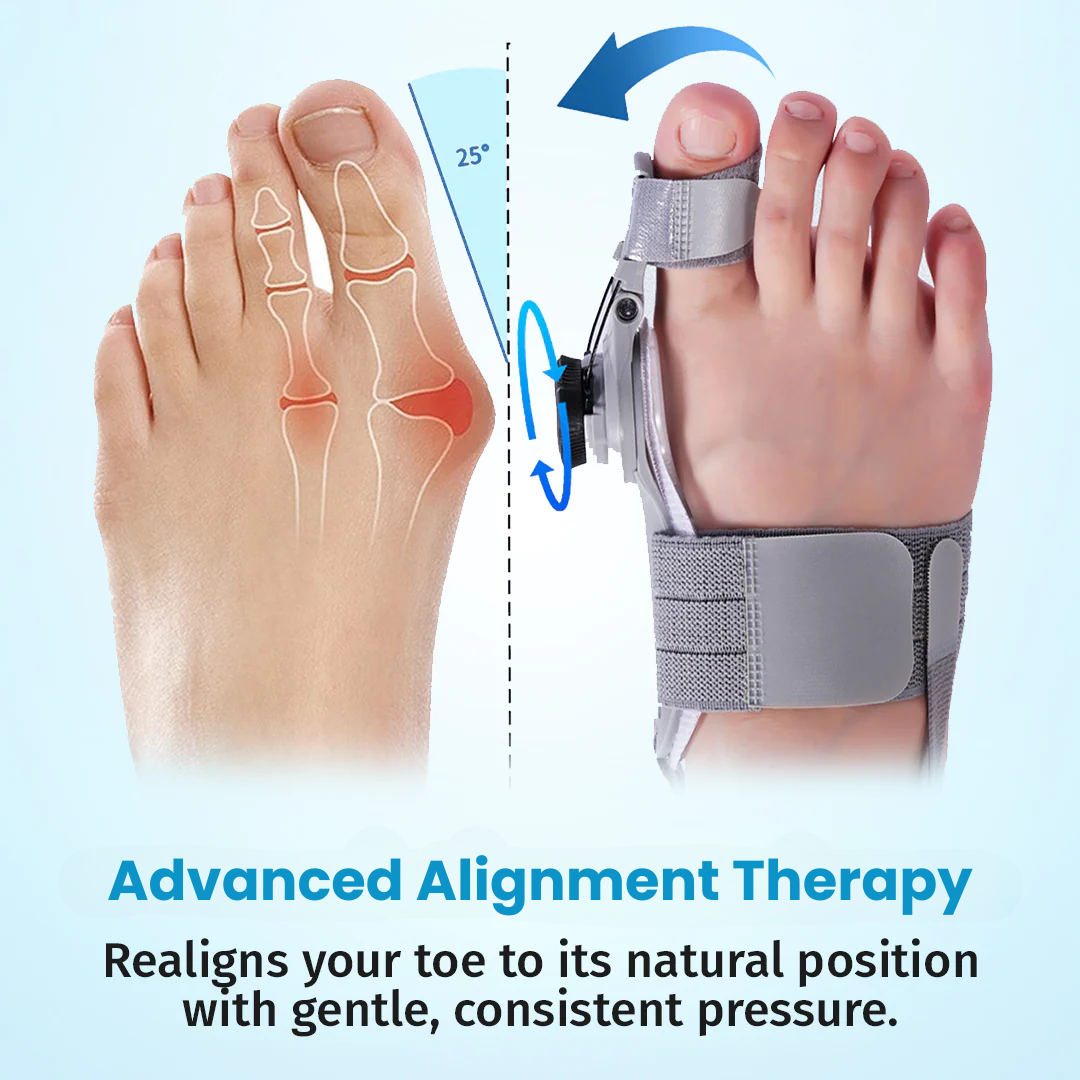 VeroStep™ Bunion Fix